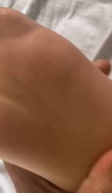 ��ϡȱ����ʵ����֪����˿�����߸���ţ��ӽ�û�з�Ӧ��