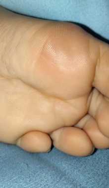 �������õĽţ�5p��