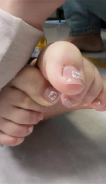 ���ȶ���˫���ҽ���˿���ȫ��ͷTK��� Σ��������